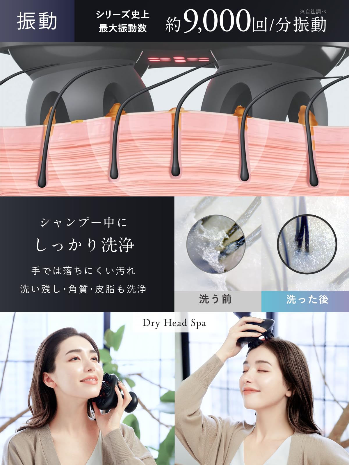 Amazon | 【九州大学博士監修】NIPLUX EMS ヘッドスパ 電動頭皮ブラシ